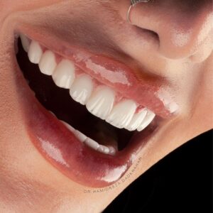 تفاوت قیمت انواع برندها