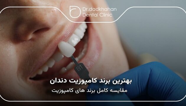 بهترین برند کامپوزیت دندان