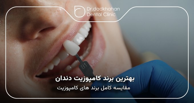 بهترین برند کامپوزیت دندان