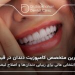 بهترین متخصص کامپوزیت دندان در قیطریه 🦷 ⭐