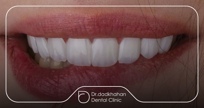 راهنمای انتخاب دکتر کامپوزیت در قیطریه