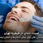 لمینت دندان در قیطریه تهران 🦷