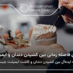 بهترین فاصله زمانی بین کشیدن دندان و ایمپلنت چیست؟🦷