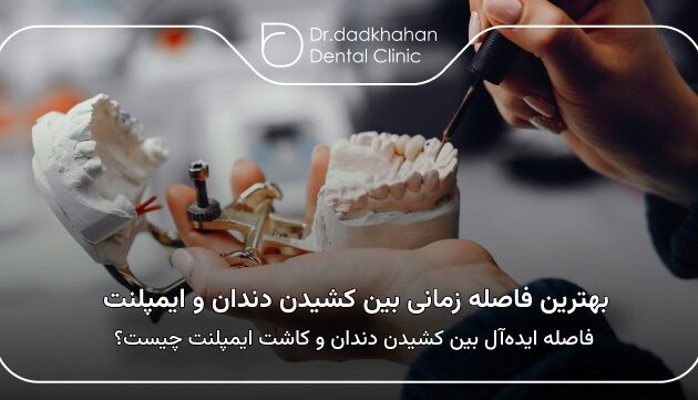 بهترین فاصله زمانی بین کشیدن دندان و ایمپلنت