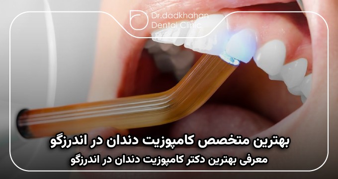 بهترین متخصص کامپوزیت دندان در اندرزگو