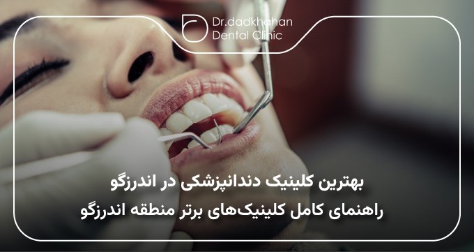 بهترین کلینیک دندانپزشکی در اندرزگو