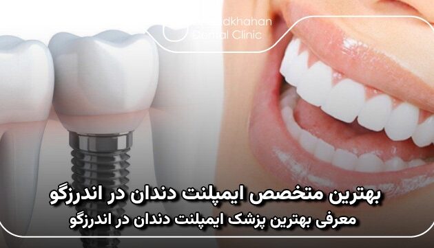 بهترین متخصص ایمپلنت دندان در اندرزگو
