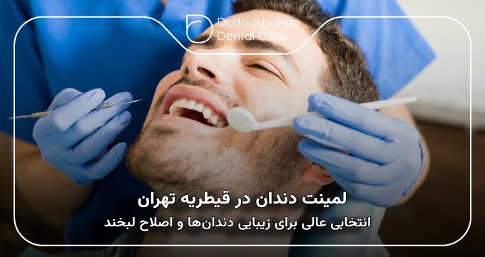 لمینت دندان در قیطریه تهران
