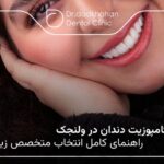 بهترین دکتر کامپوزیت دندان در ولنجک【سال1404】🦷 ⭐️