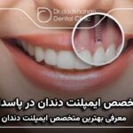 بهترین متخصص ایمپلنت دندان در پاسداران ⭐【سال 1404】