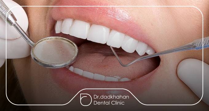 راهنمای انتخاب دکتر لمینت در اندرزگو