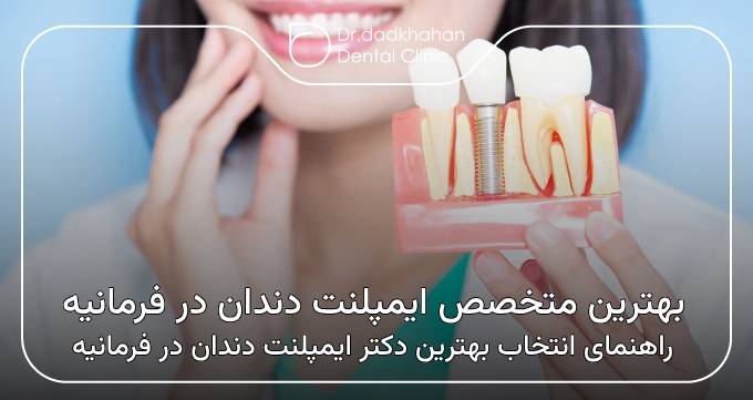 بهترین متخصص ایمپلنت دندان در فرمانیه