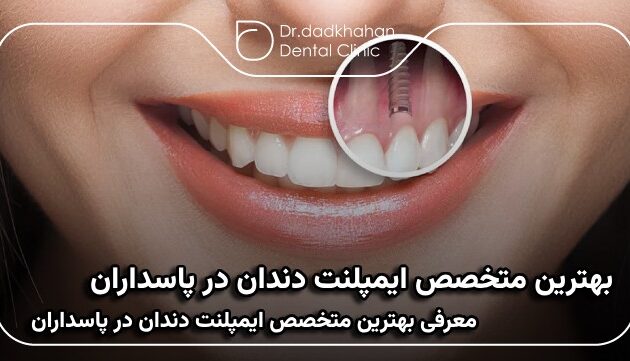 بهترین متخصص ایمپلنت دندان در پاسداران
