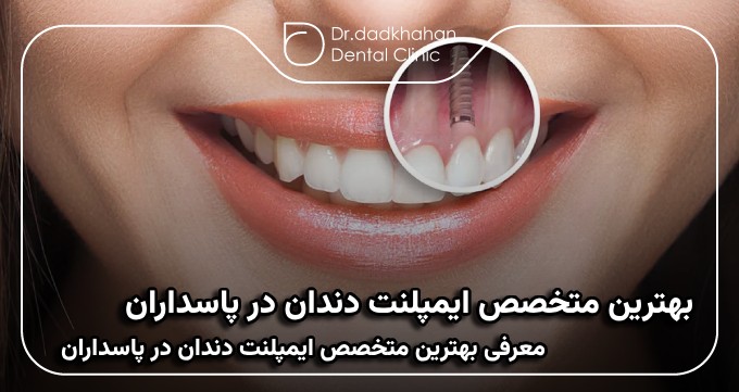 بهترین متخصص ایمپلنت دندان در پاسداران