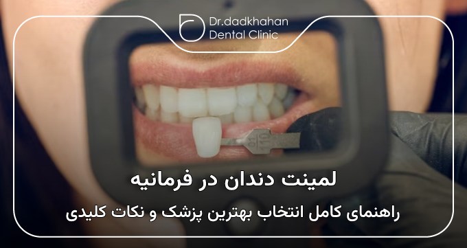 لمینت دندان درفرمانیه