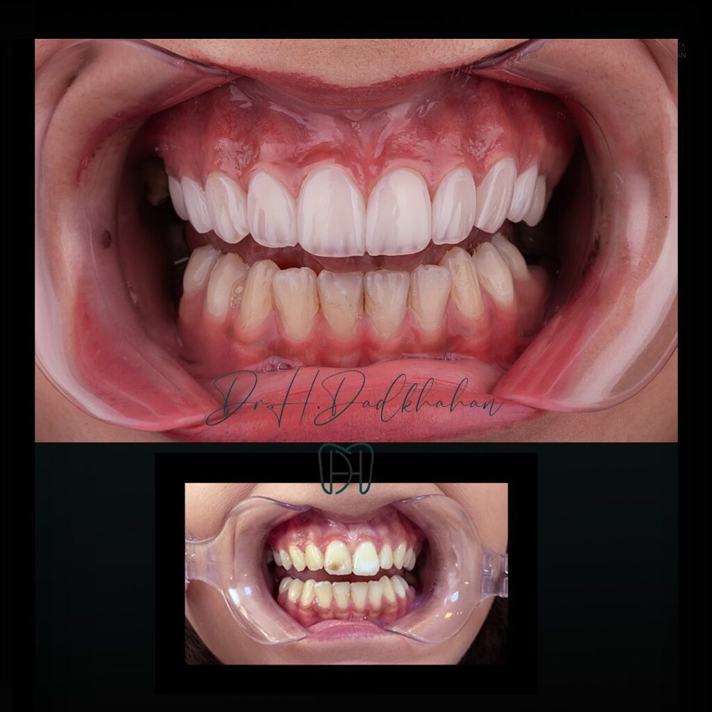 نکاتی که قبل از مراجعه به دندانپزشک باید بدانید