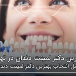 بهترین دکتر لمینت دندان در تهران ✅【سال1404】🦷