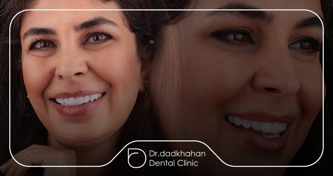 خدمات تخصصی ارائه‌شده در کلینیک‌های معتبر دندانپزشکی تهران
