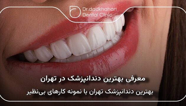 بهترین دندانپزشک در تهران با نمونه کارهای بی‌نظیر