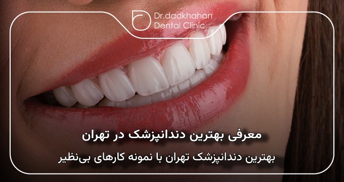 بهترین دندانپزشک در تهران با نمونه کارهای بی‌نظیر