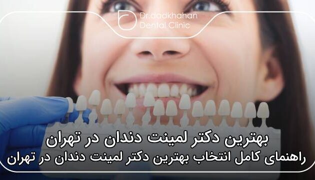 بهترین دکتر لمینت دندان در تهران