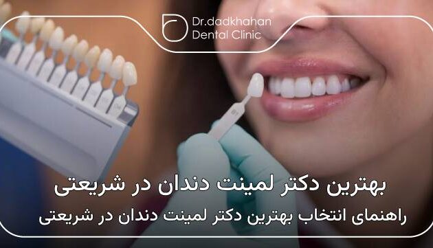 بهترین دکتر لمینت دندان در شریعتی