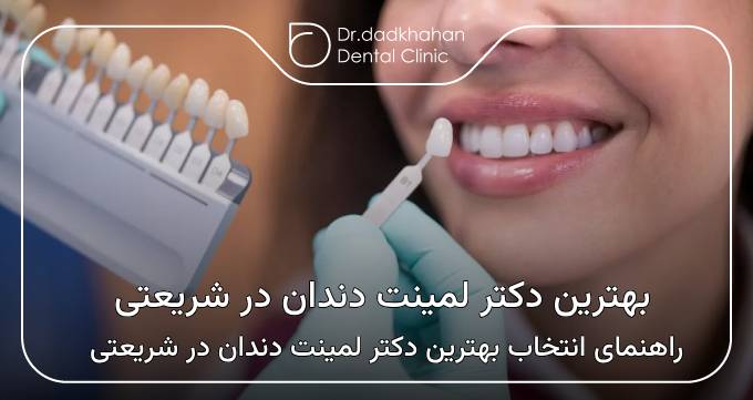 بهترین دکتر لمینت دندان در شریعتی