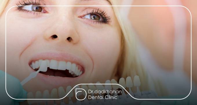 خدمات بهترین کلینیک لمینت در شریعتی