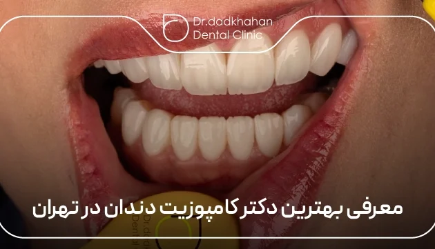 بهترین دکتر کامپوزیت دندان در تهران