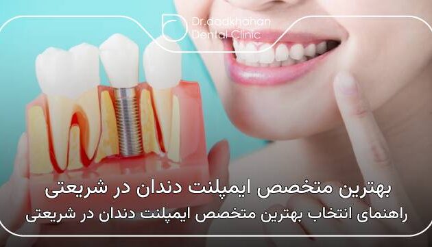 بهترین متخصص ایمپلنت دندان در شریعتی