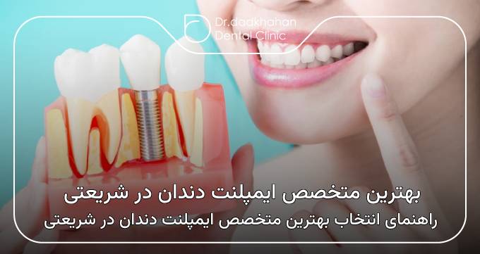 بهترین متخصص ایمپلنت دندان در شریعتی