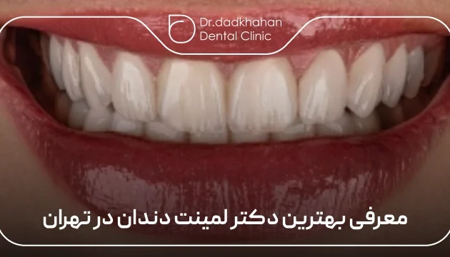 معرفی بهترین دکتر لمینت دندان در تهران