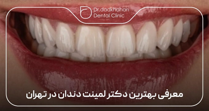 معرفی بهترین دکتر لمینت دندان در تهران