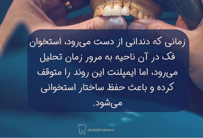 نکاتی که هنگام انتخاب بهترین متخصص ایمپلنت دندان در تجریش باید بدانید
