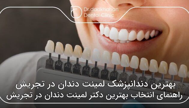 بهترین دندانپزشک لمینت دندان در تجریش