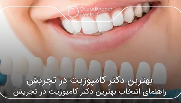 بهترین دکتر کامپوزیت در تجریش