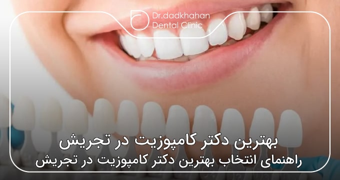 بهترین دکتر کامپوزیت در تجریش