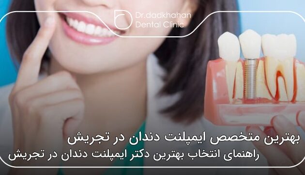 بهترین متخصص ایمپلنت دندان در تجریش