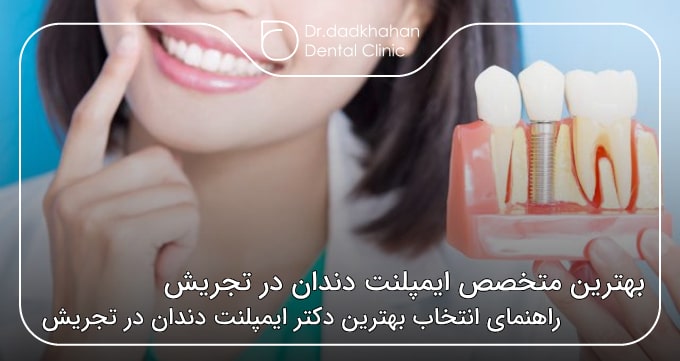 بهترین متخصص ایمپلنت دندان در تجریش