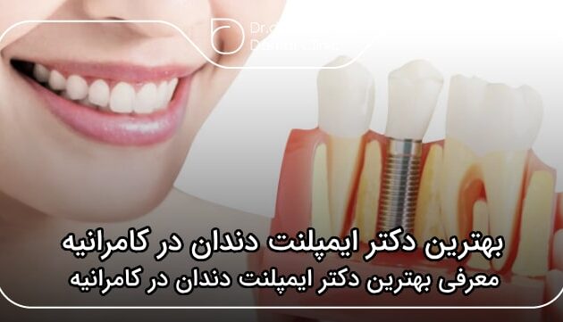 بهترین دکتر ایمپلنت دندان در کامرانیه
