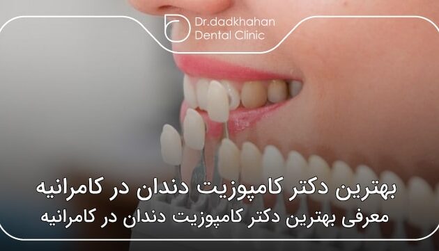 بهترین دکتر کامپوزیت دندان در کامرانیه
