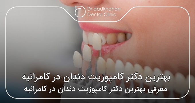 بهترین دکتر کامپوزیت دندان در کامرانیه