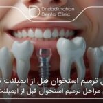 مراحل ترمیم استخوان قبل از ایمپلنت دندان ⚡【سال1404】🦷