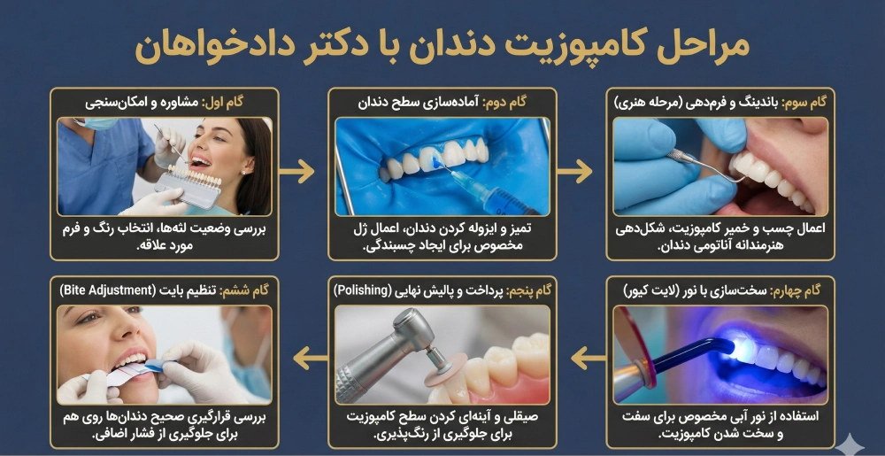 مراحل گامبهگام انجام کامپوزیت در کلینیک دکتر دادخواهان