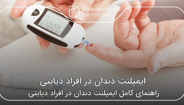 ایمپلنت دندان در افراد دیابتی