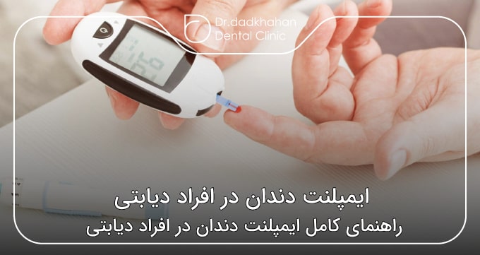 ایمپلنت دندان در افراد دیابتی