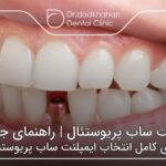 ایمپلنت ساب پریوستئال | راهنمای جامع 🦷【سال1404】⭐