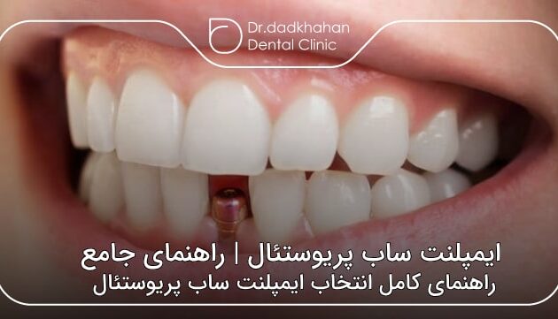 ایمپلنت ساب پریوستئال