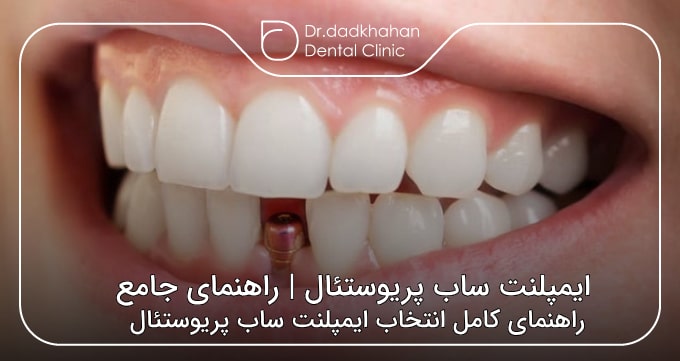 ایمپلنت ساب پریوستئال