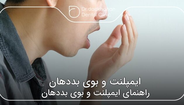 ایمپلنت و بوی بددهان